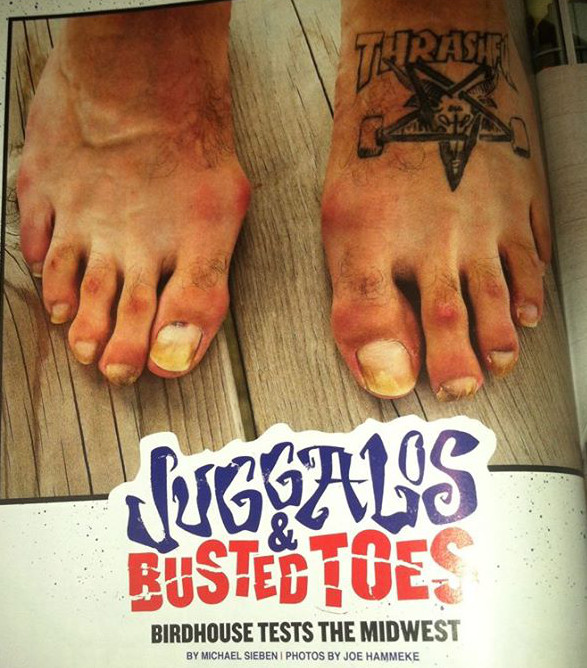 Juggalos&BustedToes-th