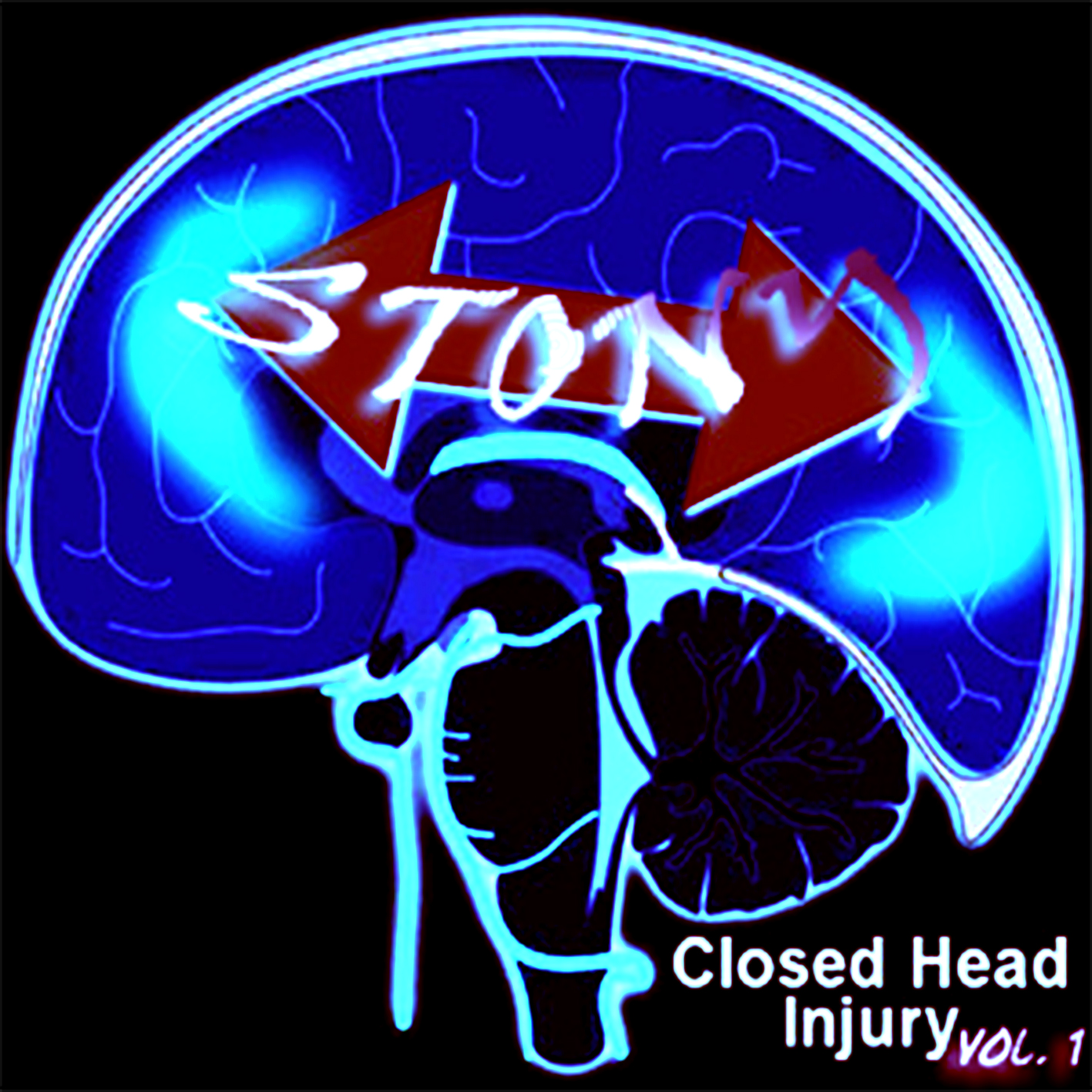 stony_closedheadinjuryvol1